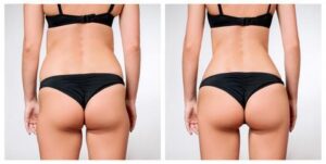 Perfect Body Cellulite- où acheter - en pharmacie - sur Amazon - site du fabricant - prix